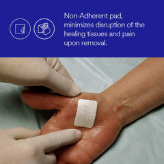 Close-up of 3M Tegaderm +Pad film dressing highlights transparent, conforming film.