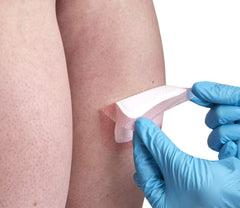 Allevyn Gentle Border dressing on skin demonstrates breathable wear and protection.