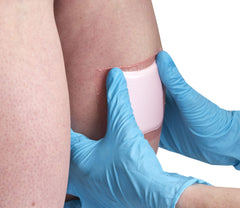 Allevyn Gentle Border on skin highlights gentle adhesion and secure fit.