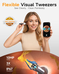 Anyear 10MP HD otoscope delivers a clear view of the ear canal.