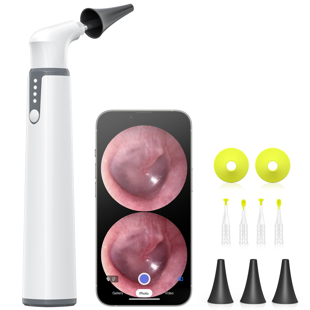AnyScope wireless otoscope with gyroscope provides stable orientation for clear ear canal visuals.