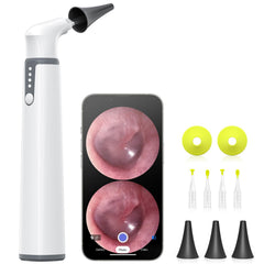 AnyScope wireless otoscope with gyroscope provides stable orientation for clear ear canal visuals.