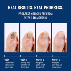 Approved Science Fungix label highlights 25% undecylenic acid for targeted nail care.