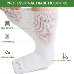 Artfasion edema socks non-binding design supports comfortable circulation in swollen ankles.