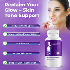 Aura Vitamins Vitiligo Capsules box close-up highlighting premium blend.