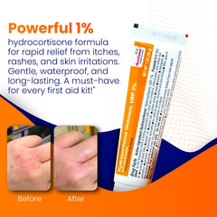 AVEDANA Hidrocortisona Ungüento, tubo práctico para uso diario en irritaciones menores.