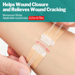 AZEN zip stitch wound closure close-up showing easy adjustment.