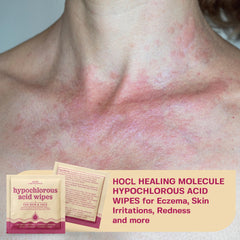 Base Laboratories individually wrapped HOCl wipes for convenient daily use.