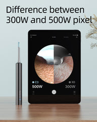 BEBIRD Camera with 6 LED Lights brightens the ear canal for precise viewing.
