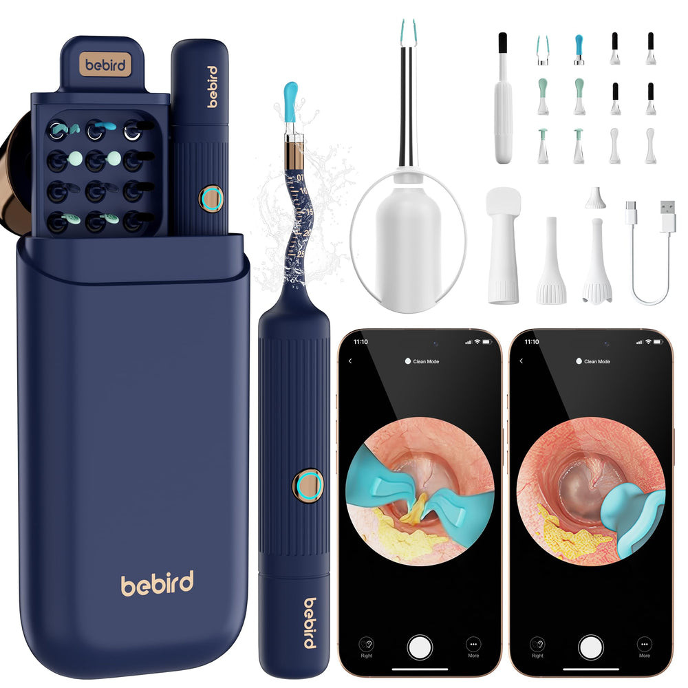 BEBIRD Earsight Plus camera view showing clear ear canal visuals for precise cleaning