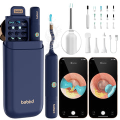 BEBIRD Earsight Plus camera view showing clear ear canal visuals for precise cleaning