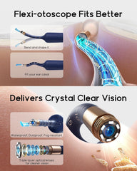 BEBIRD Earsight Plus D39R painless ear tweezers for gentle cleaning