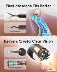 BEBIRD Earsight Plus R37R soft tip protects skin during wax removal