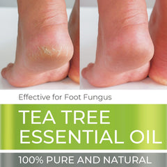 Being Naturals Tea Tree Oil in an aromatherapy diffuser for a refreshing ambiance.