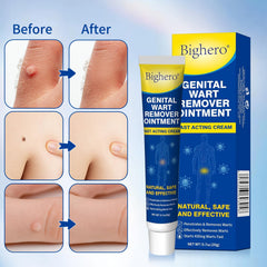 Bighero 2-pack wart remover kit offering value and ongoing treatment options.
