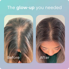 Front view of Biosil Advanced Hair + Nail Care packaging highlighting vegan formula