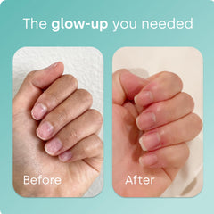 Ch-OSA activator illustration showing patented collagen support concept.