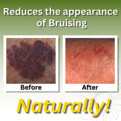 Relief Arnica Cream texture closeup demonstrates smooth glide for professional massage sessions.