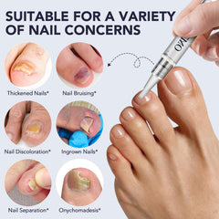 BXRUIAGN Toenail Fungus Pen application area near affected nails