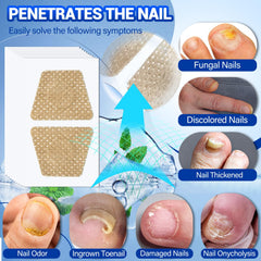 Textura hidrogel de parches Comfort para reparación suave de uñas.