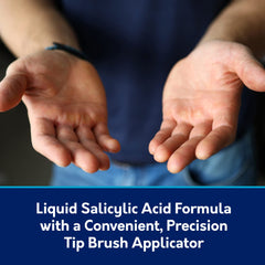 Closeup of Compound W bottle and brush for targeted wart treatment
