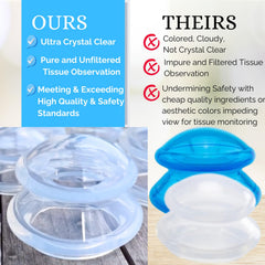 Cupping Warehouse Supreme 4 medium cup targeting back and neck relief for home use.