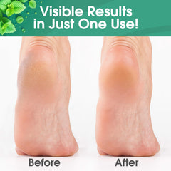 DeEnti double-sided foot file with two coarseness levels for versatile care