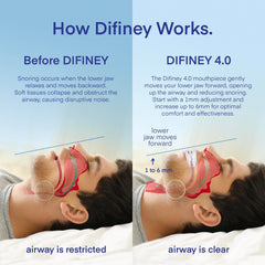 Difiney 4.0 inside view highlighting personalized fit for comfort