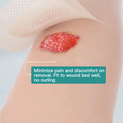 Dimora absorbent foam core captures wound fluid efficiently for moderate to high exudate