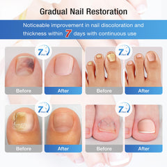 DR.RAPID precision brush enables mess-free nail repair application.