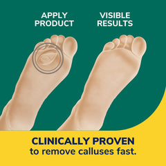 Dr. Scholl's Almohadilla hidrogel: cobertura suave y flexible