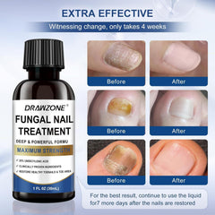 Drawzone dual-action nail renewal improves appearance and strength