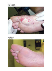 Eras Natural Sciences Wound Honey texture close-up shows natural crystallization for purity.