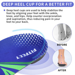 FitFeet high-arch support close-up shows stabilization of the midfoot for activities