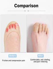 Fizzest toe protector sleeve guards toes during walking and running.
