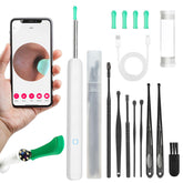 Fjordiony WiFi Otoscope 1080p camera view enables detailed ear inspection.