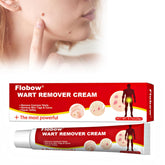 Flobow Wart Remover 20g cream application targets warts and corns.