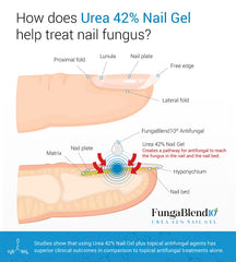 FungaBlend 10 Urea 42% brush applicator enables precise top-nail application