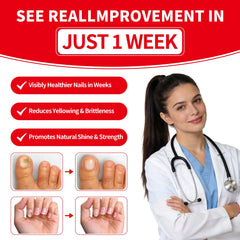 Gemächlich ZuHause yellowed nails repair visual with pen application.