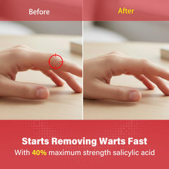 Goodnites Wart Remover Pads highlight 6mm medicated center for small wart coverage