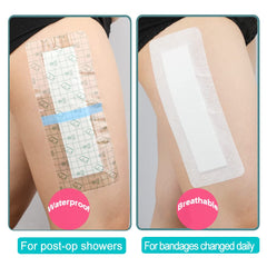 GoToHere showerproof patch allows showering while keeping the wound dry.
