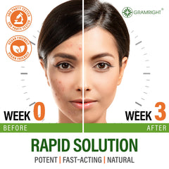 GRAMRIGHT Perfect Skin Acne Pills capsules ready for daily intake balancing sebum.