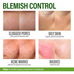 GRAMRIGHT Perfect Skin Acne Pills packaging and bottle for easy storage.