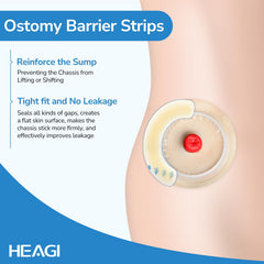 Heagimed ostomy barrier strips applied around stoma for secure, comfortable fit.