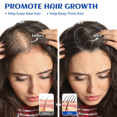 HIQILI Rosemary Oil dropper bottle for easy dosing in hair care