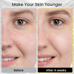 Iarha near-infrared glow on face mask back view for deep treatment