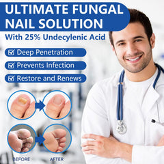 IFUNSHAR precision applicator enables targeted nail treatment