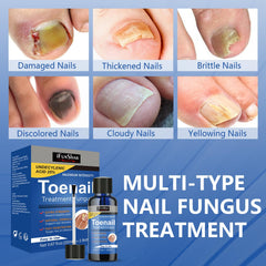 IFUNSHAR treatment shown on yellow nails before and after results