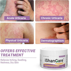 iShanCare Urticaria Cream label closeup highlighting natural ingredients.