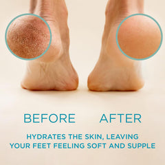 Lee Beauty Pro gel remover targets cracked heels for a more comfortable foot.